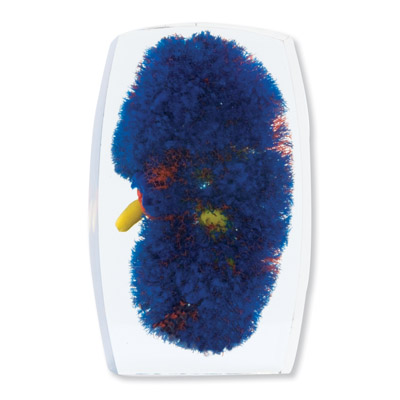 ��Ѫ��ģ�ͣ��졢��������