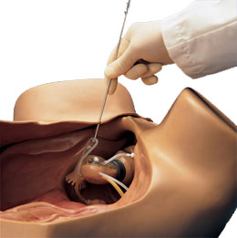 ����ģ��